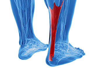 Achilles Tendonitis Treatment in the Queens County, NY: Flushing (College Point, Linden Hill, Malba, Whitestone, Jackson Heights, Corona) and Elmhurst, NY (Forest Hills, Kew Garden Hills, Utopia, Murray Hills, Auburndale, Fresh Meadows, Sunnyside, Maspeth, Woodside) areas